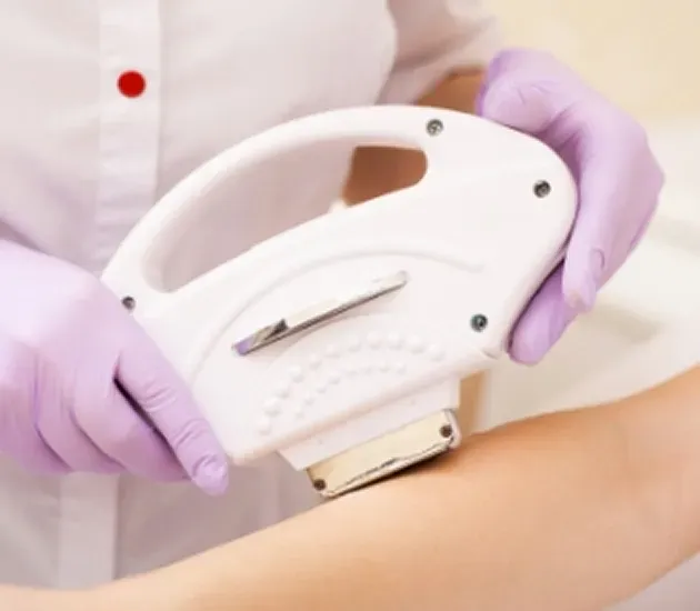 施術を受ける女性と専用の脱毛器